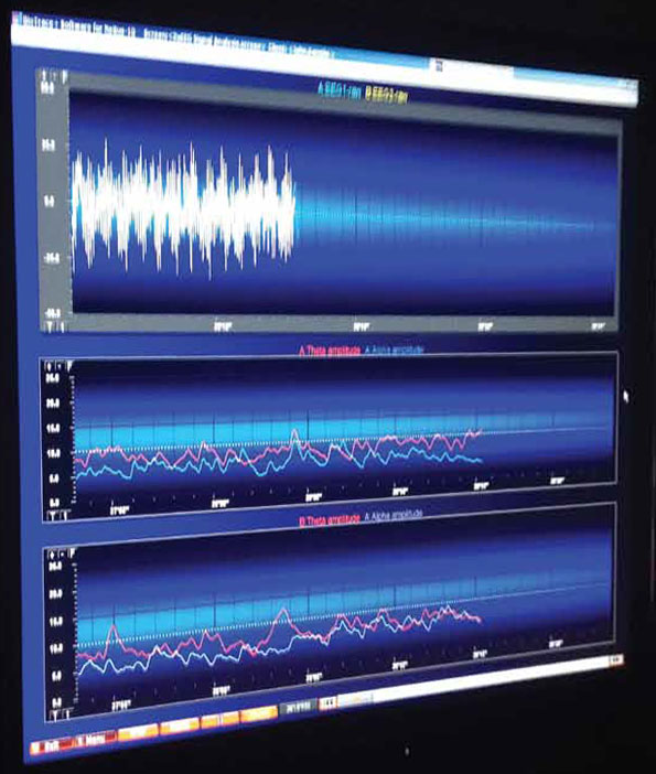 biofeedback